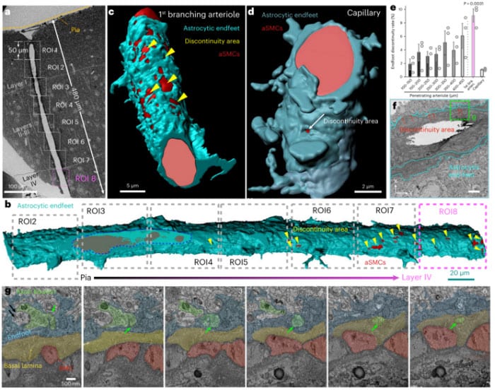  Contact between aSMCs and axons through gaps in astrocytic endfeet