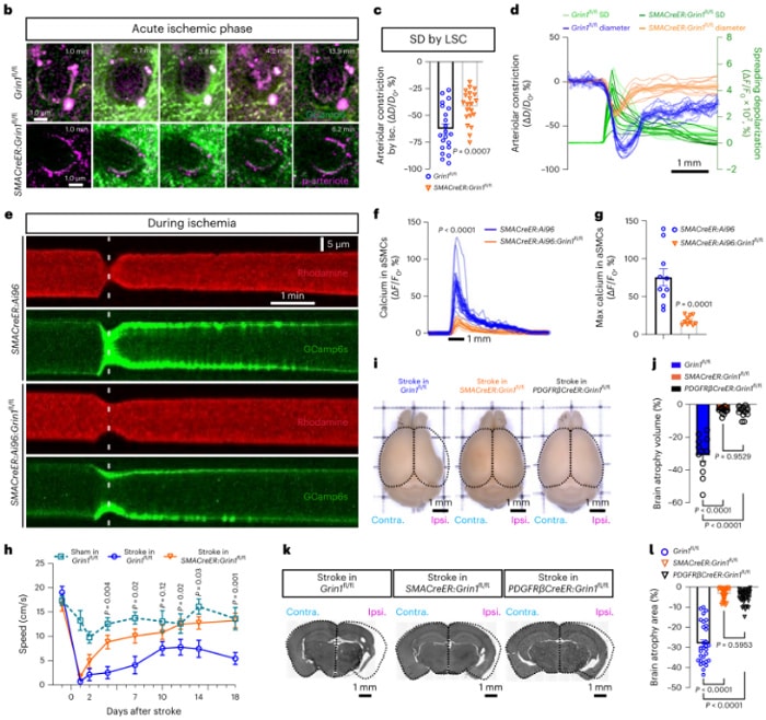 Knocking out GluN1 in aSMCs promotes functional recovery after ischemic stroke